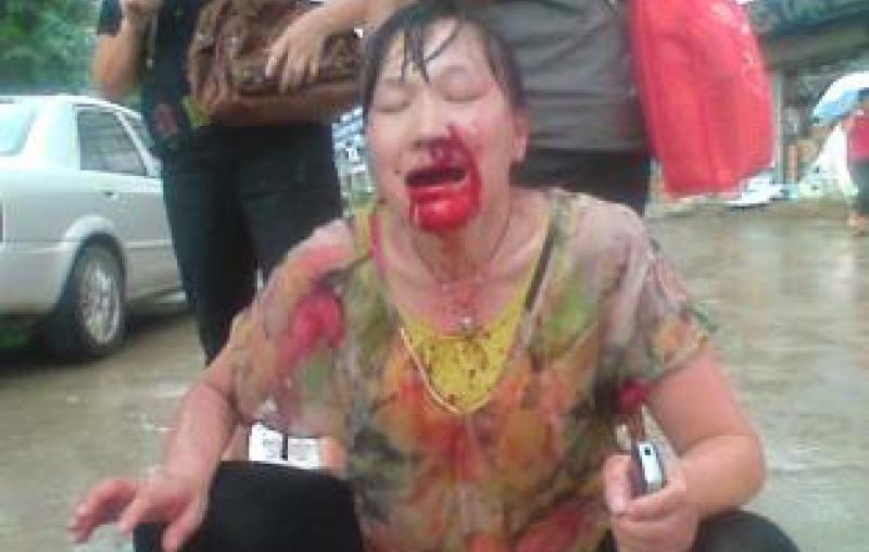 We Condemn Violence against Workers' Representatives---An Open Letter by Gold Peak (GP) Battery Workers